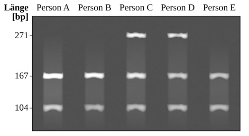 Gelbild mit DNA-Banden von Person A bis E auf einem Größenmarker.